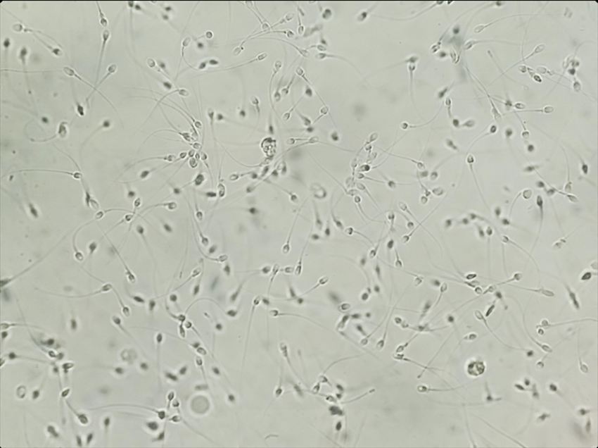 マイクロプラスチックは精液中からも検出され、精子の数や運動性に影響を与える可能性が指摘されている